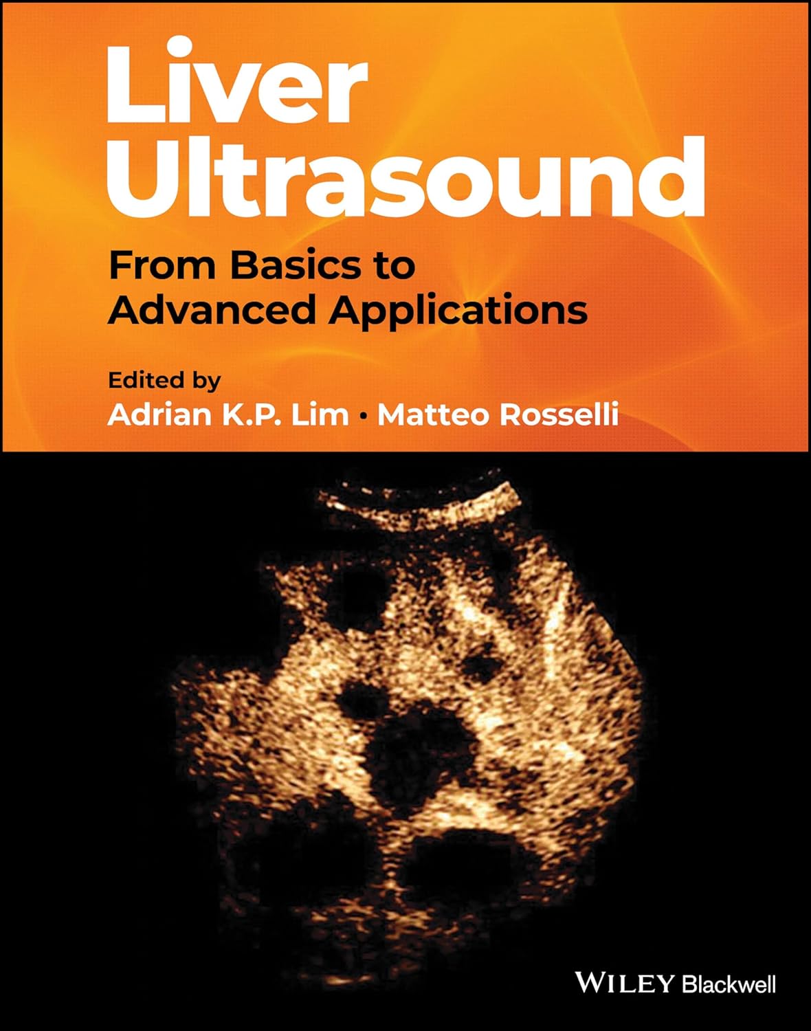 Coperta cărții "Liver Ultrasound: From Basics to Advanced Applications" de autor necunoscut