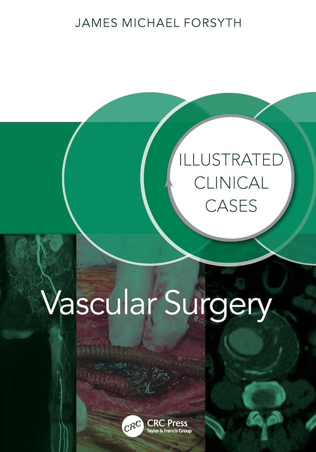 Coperta cărții "Vascular Surgery: Illustrated Clinical Cases" de autor necunoscut