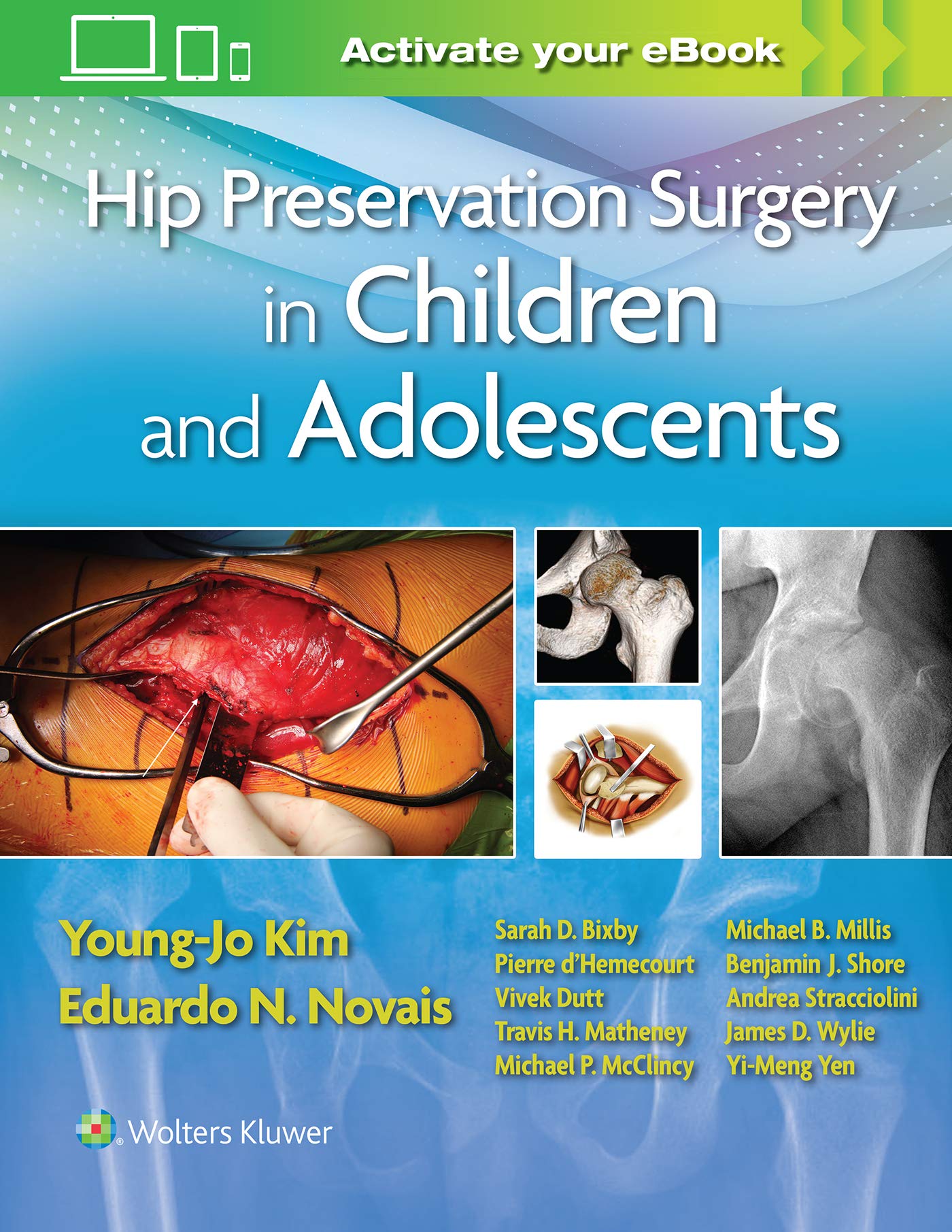 Coperta cărții "Hip Preservation Surgery in Children and Adolescents" de autor necunoscut