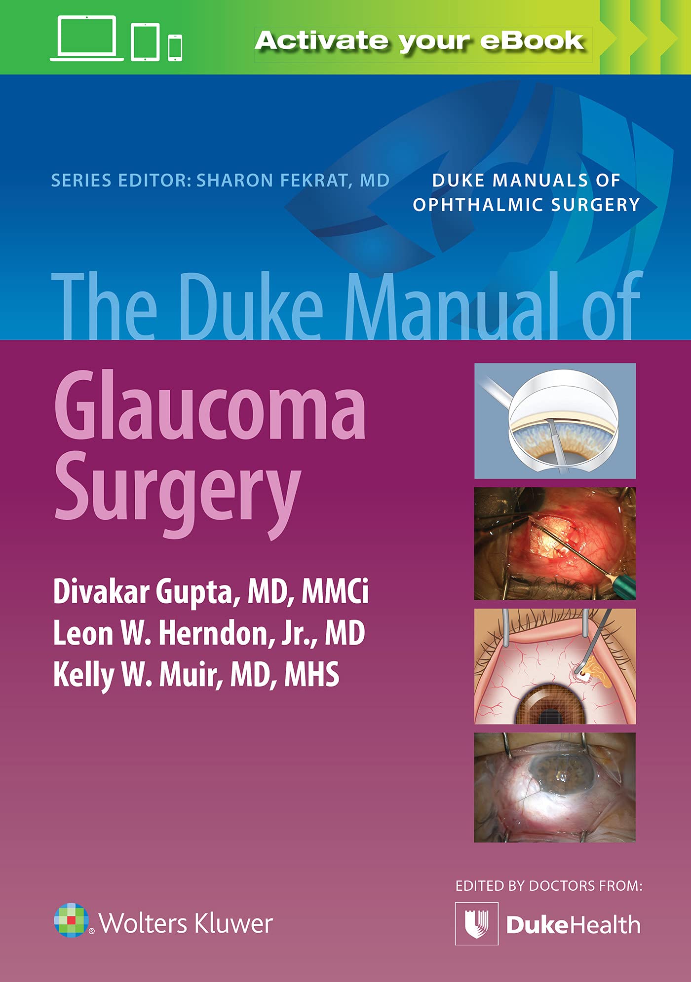 Coperta cărții "The Duke Manual of Glaucoma Surgery" de autor necunoscut