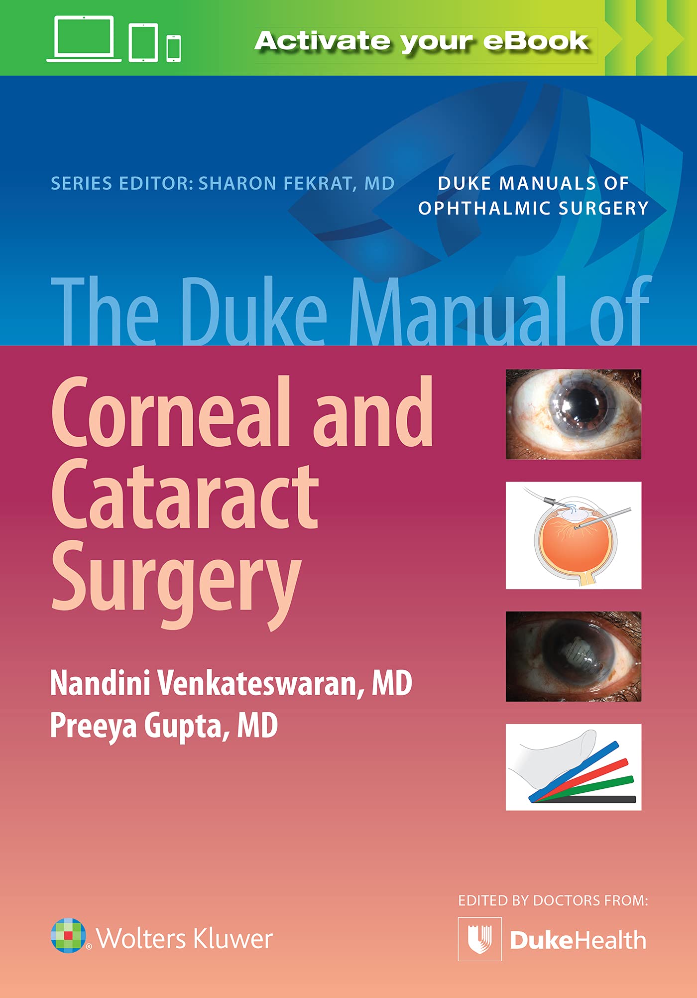 Coperta cărții "The Duke Manual of Corneal and Cataract Surgery" de autor necunoscut