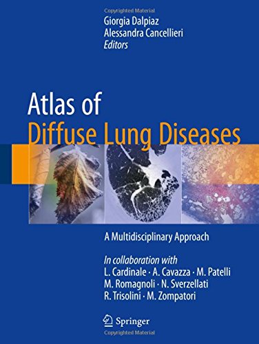 Coperta cărții "Atlas of Diffuse Lung Diseases" de autor necunoscut