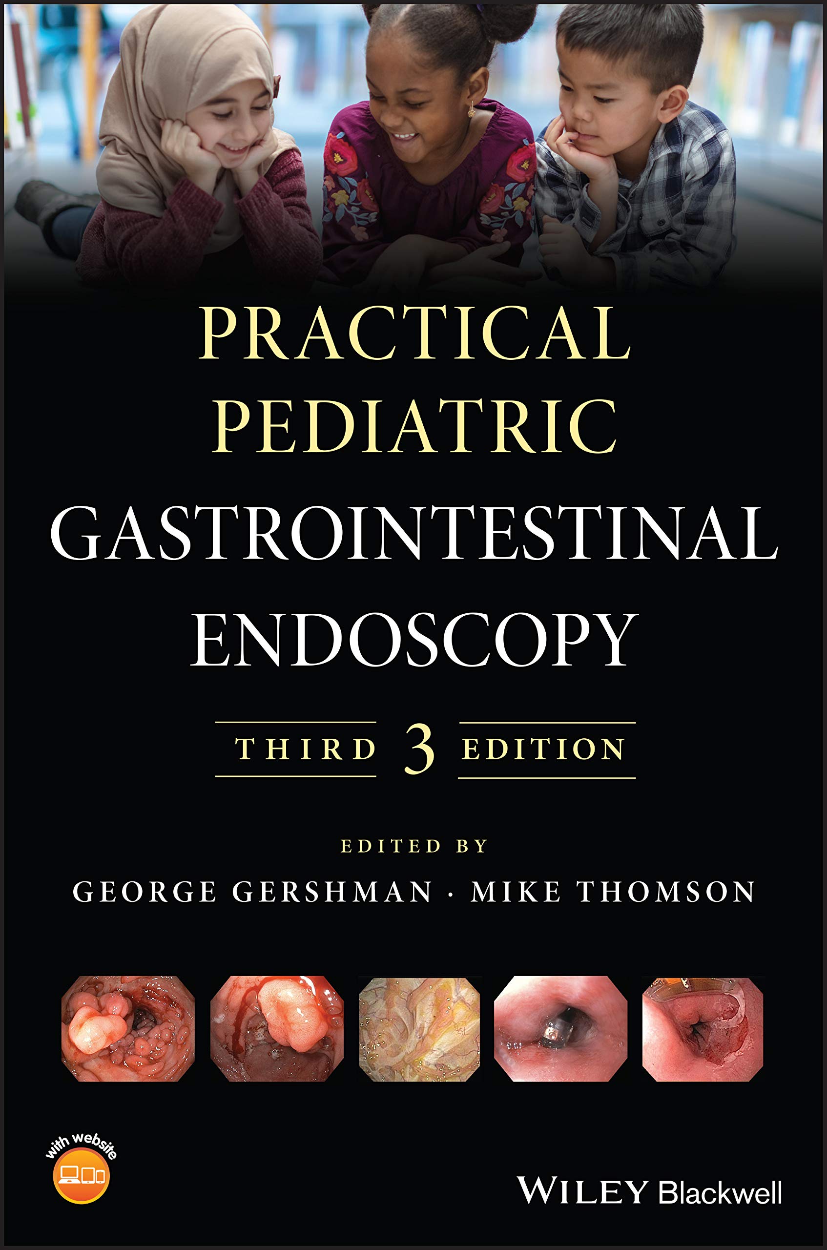 Coperta cărții "Practical Pediatric Gastrointestinal Endoscopy" de autor necunoscut