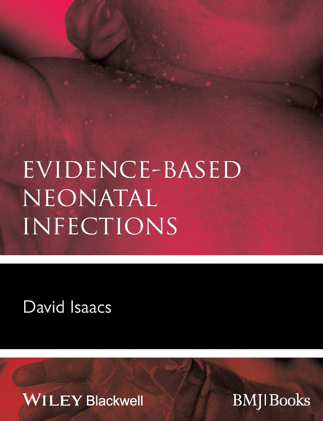 Coperta cărții "Evidence-Based Neonatal Infections" de autor necunoscut