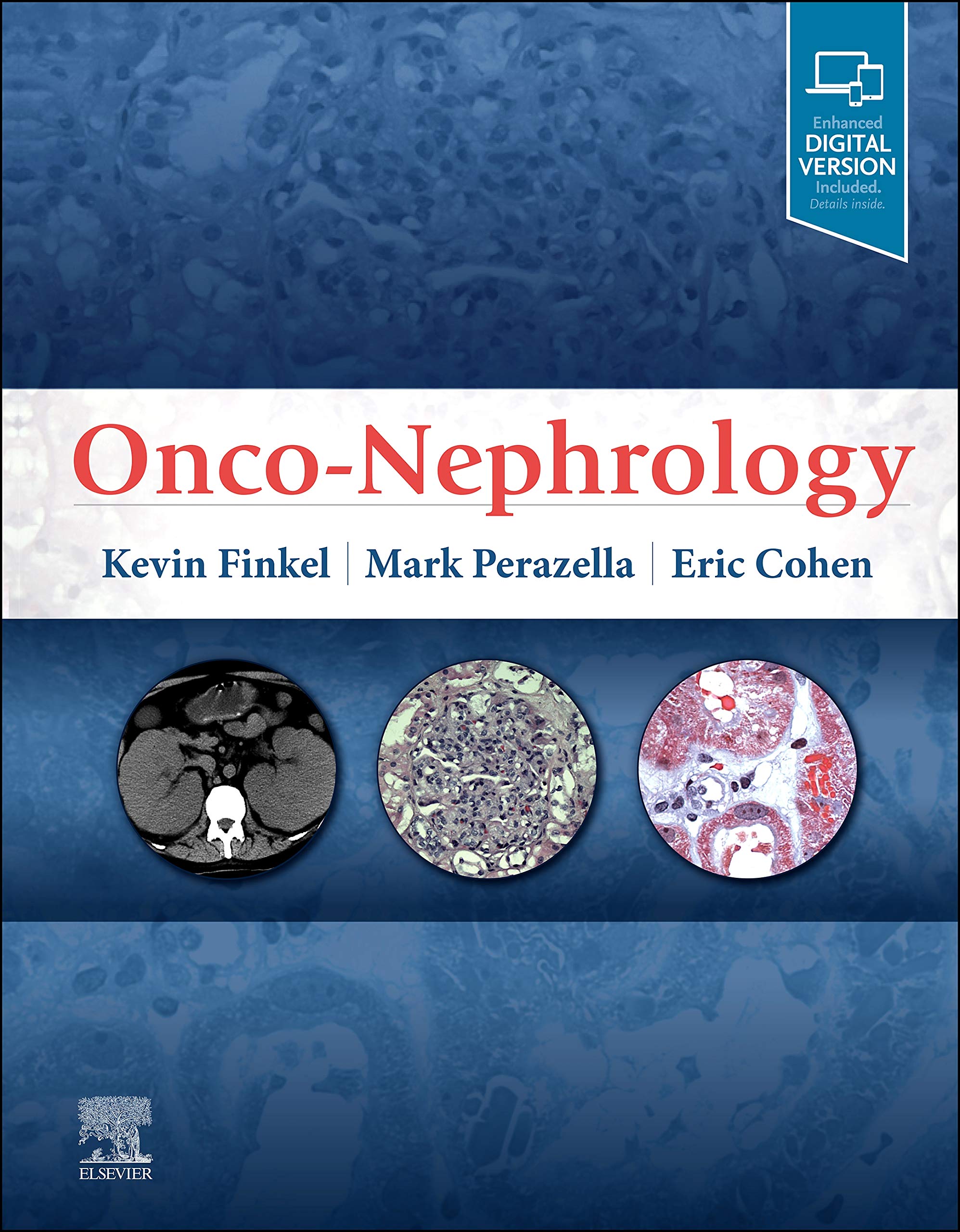 Coperta cărții "Onco-Nephrology" de autor necunoscut