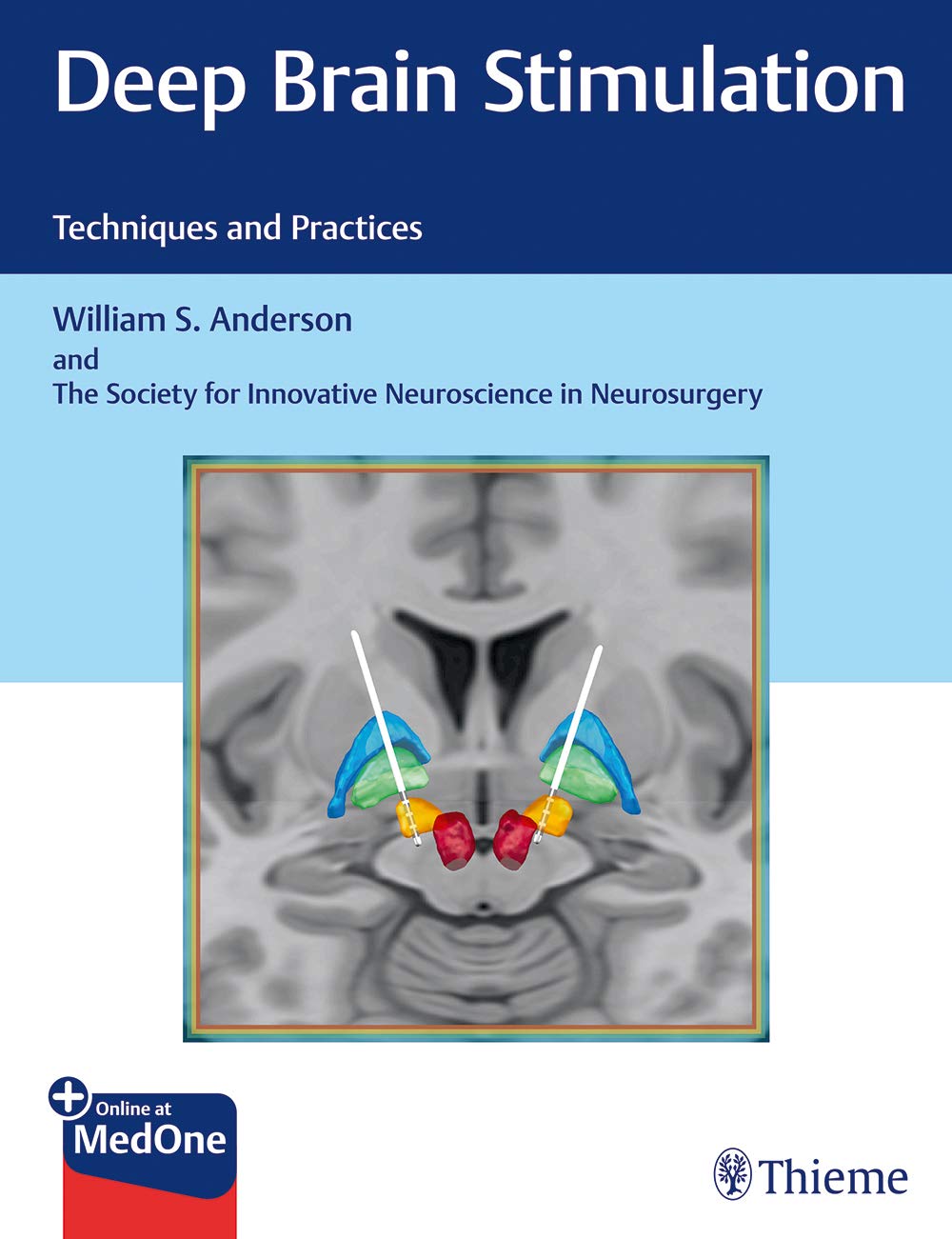 Coperta cărții "Deep Brain Stimulation: Techniques and Practices" de autor necunoscut