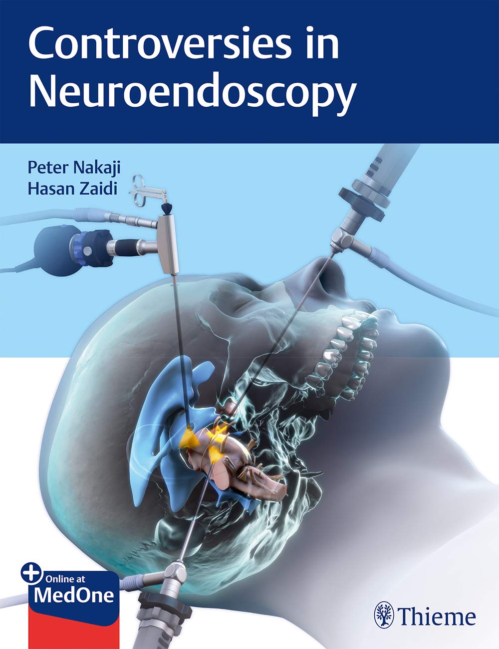 Coperta cărții "Controversies in Neuroendoscopy" de autor necunoscut