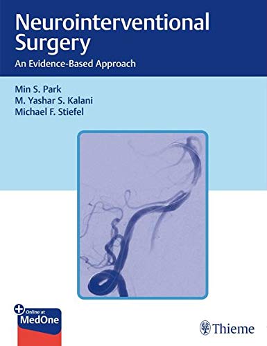 Coperta cărții "Neurointerventional Surgery: An Evidence-Based Approach" de autor necunoscut