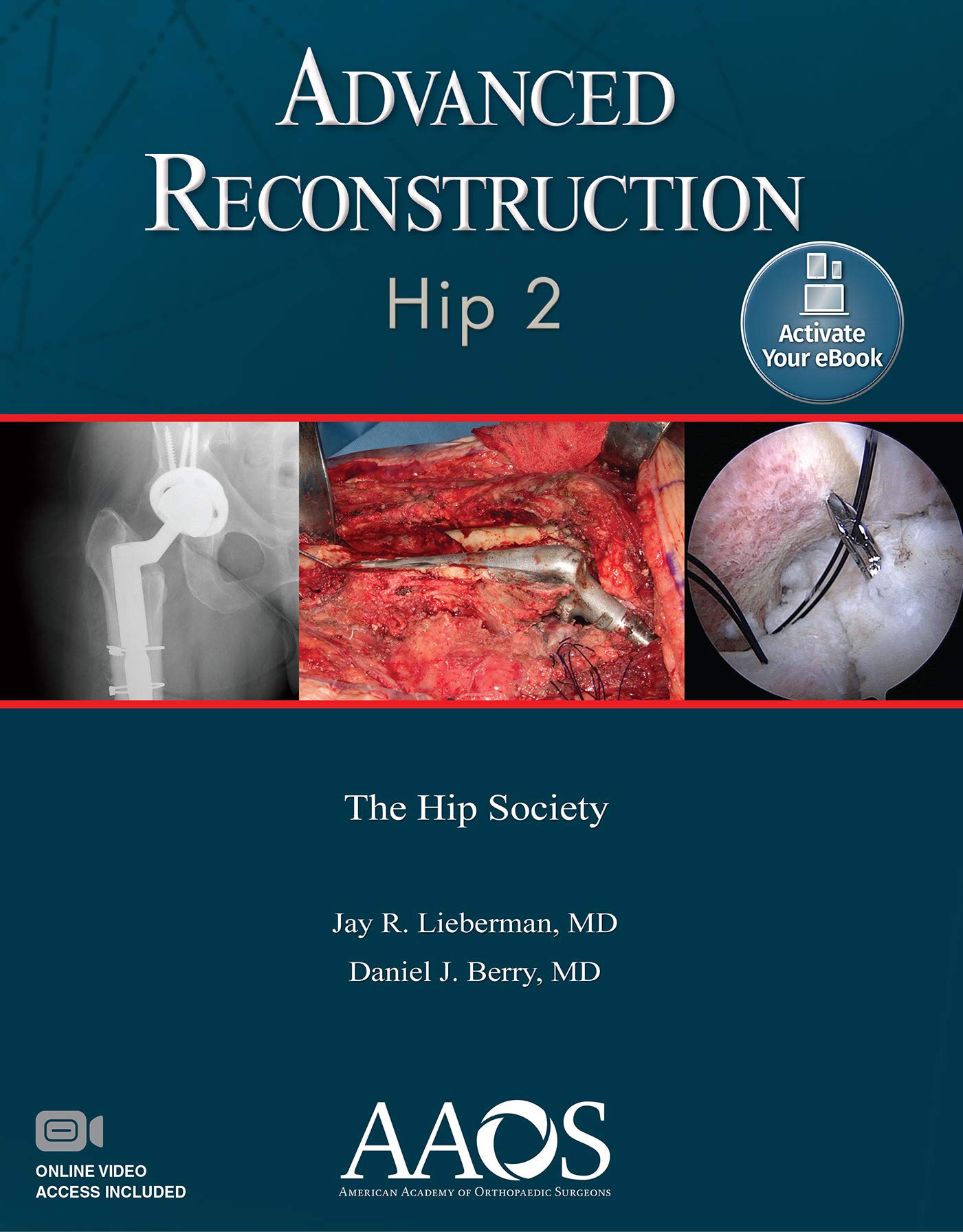 Coperta cărții "Advanced Reconstruction: Hip 2" de autor necunoscut