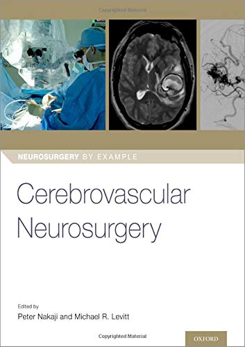 Coperta cărții "Cerebrovascular Neurosurgery" de autor necunoscut