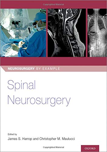 Coperta cărții "Spinal Neurosurgery" de autor necunoscut