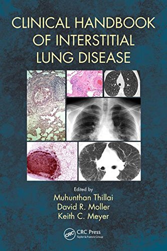 Coperta cărții "Clinical Handbook of Interstitial Lung Disease" de autor necunoscut