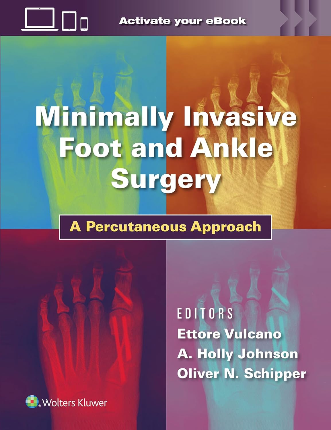 Coperta cărții "Minimally Invasive Foot and Ankle Surgery: A Percutaneous Approach" de autor necunoscut
