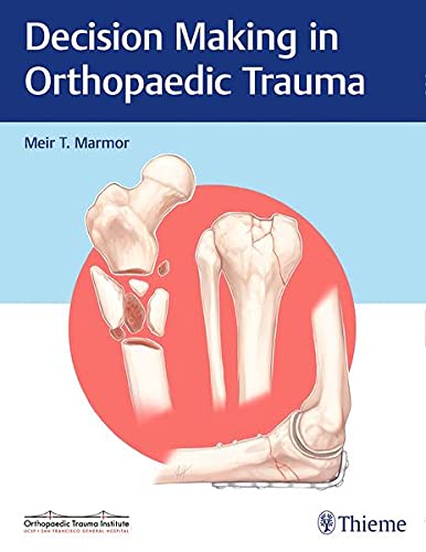 Coperta cărții "Decision Making in Orthopaedic Trauma" de autor necunoscut