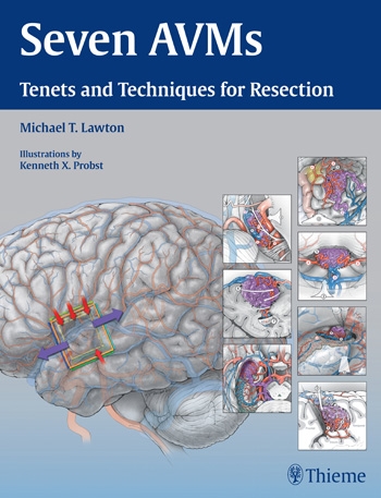 Coperta cărții "Seven AVMs" de autor necunoscut