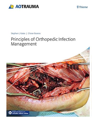 Coperta cărții "Principles of Orthopedic Infection Management" de autor necunoscut