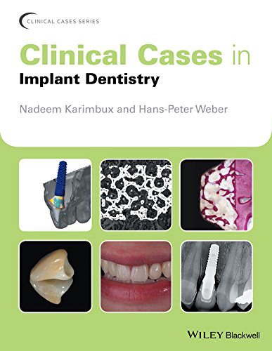 Coperta cărții "Clinical Cases in Implant Dentistry" de autor necunoscut