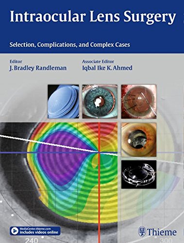 Coperta cărții "Intraocular Lens Surgery" de autor necunoscut