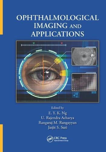 Coperta cărții "Ophthalmological Imaging and Applications" de autor necunoscut