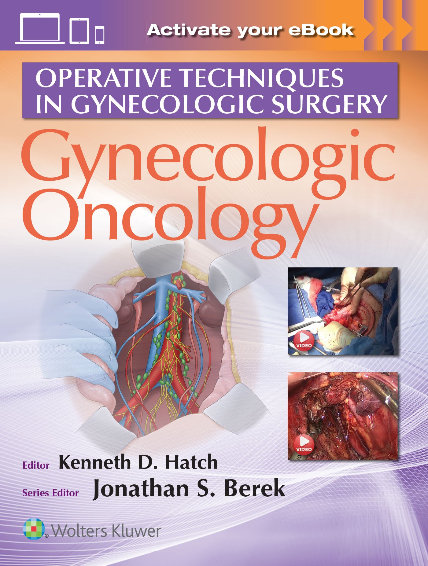 Coperta cărții "Operative Techniques in Gynecologic Surgery: Gynecologic Oncology" de autor necunoscut