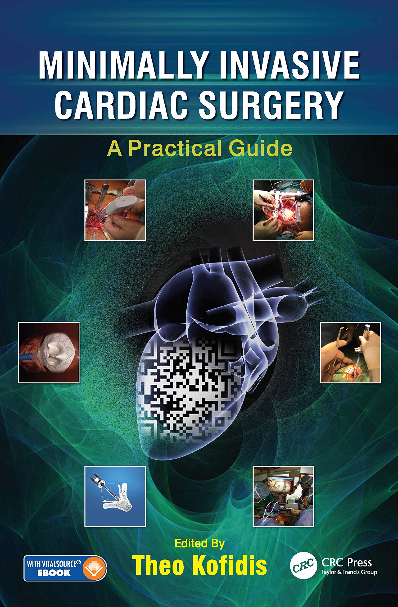 Coperta cărții "Minimally Invasive Cardiac Surgery: A Practical Guide" de autor necunoscut