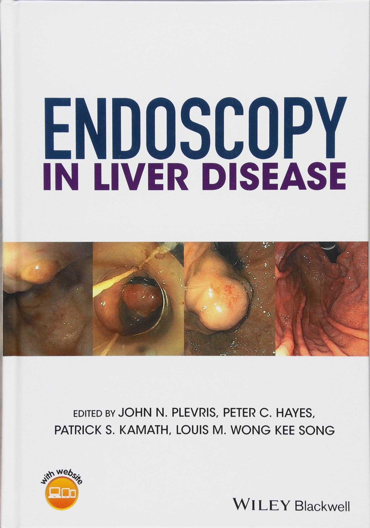 Coperta cărții "Endoscopy in Liver Disease" de autor necunoscut