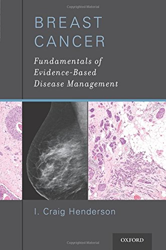 Coperta cărții "Breast Cancer. Fundamentals of Evidence-Based Disease Management" de autor necunoscut