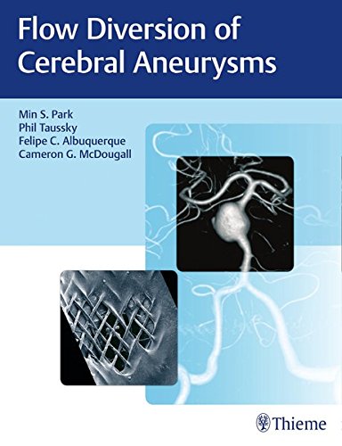 Coperta cărții "Flow Diversion of Cerebral Aneurysms" de autor necunoscut