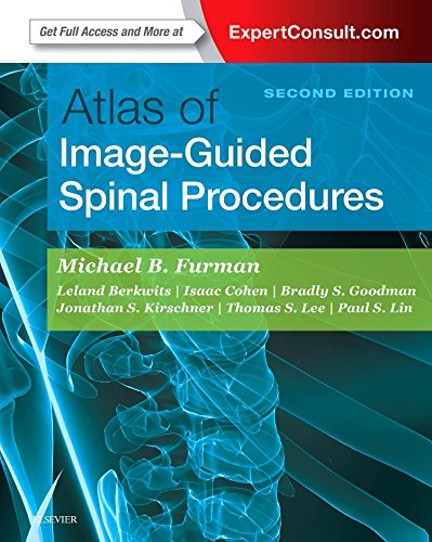 Coperta cărții "Atlas of Image-Guided Spinal Procedures, 2e" de autor necunoscut