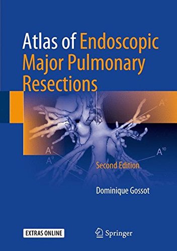 Coperta cărții "Atlas of Endoscopic Major Pulmonary Resections" de autor necunoscut