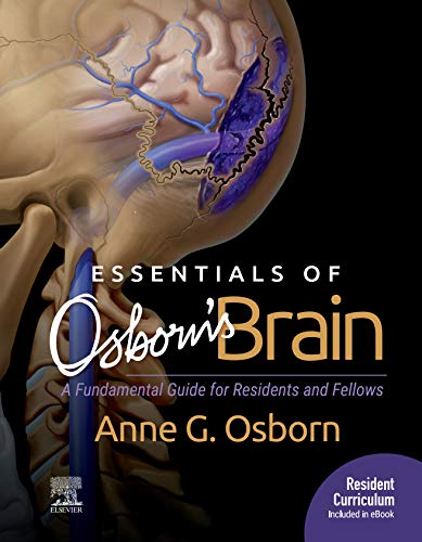 Coperta cărții "Essentials of Osborn&amp;#146;s Brain" de autor necunoscut