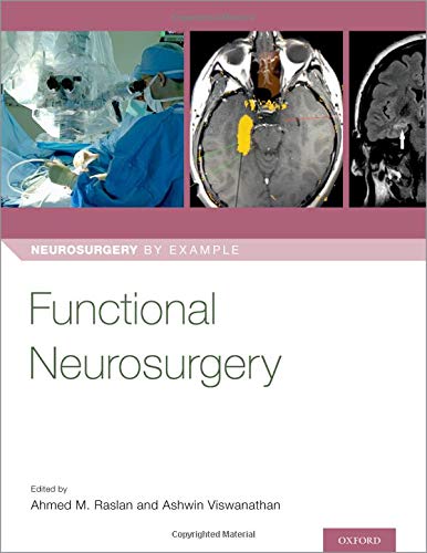 Coperta cărții "Functional Neurosurgery (Neurosurgery by Example)" de autor necunoscut
