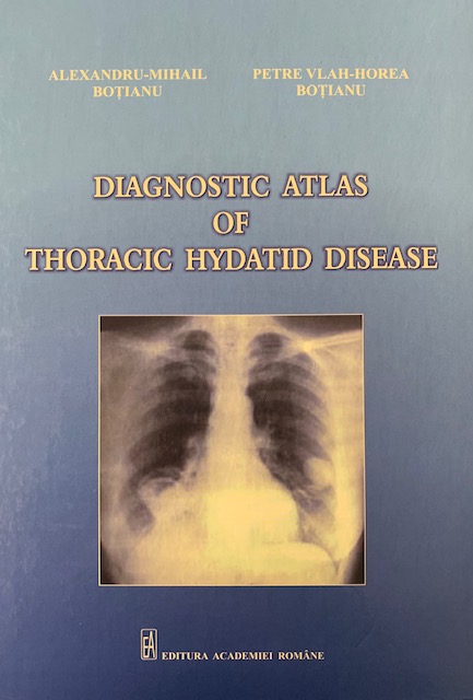 Coperta cărții "Diagnostic atlas of thoracic hydatid disease" de autor necunoscut