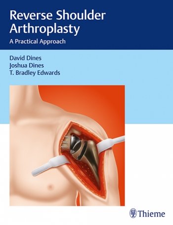 Coperta cărții "Reverse Shoulder Arthroplasty: A Practical Approach" de autor necunoscut