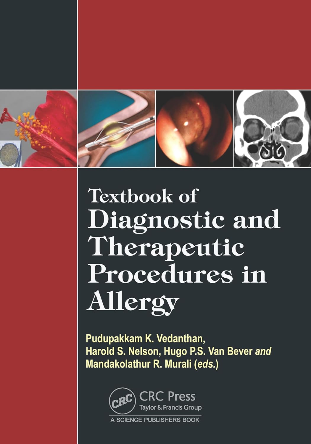 Coperta cărții "Textbook of Diagnostic and Therapeutic Procedures in Allergy" de autor necunoscut