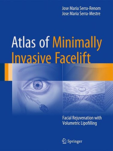 Coperta cărții "Atlas of Minimally Invasive Facelift: Facial Rejuvenation with Volumetric Lipofilling" de autor necunoscut