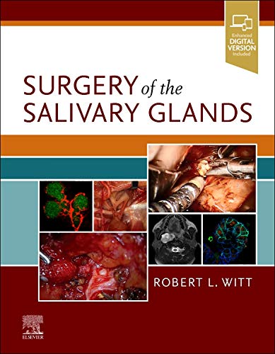 Coperta cărții "Surgery of the Salivary Glands" de autor necunoscut