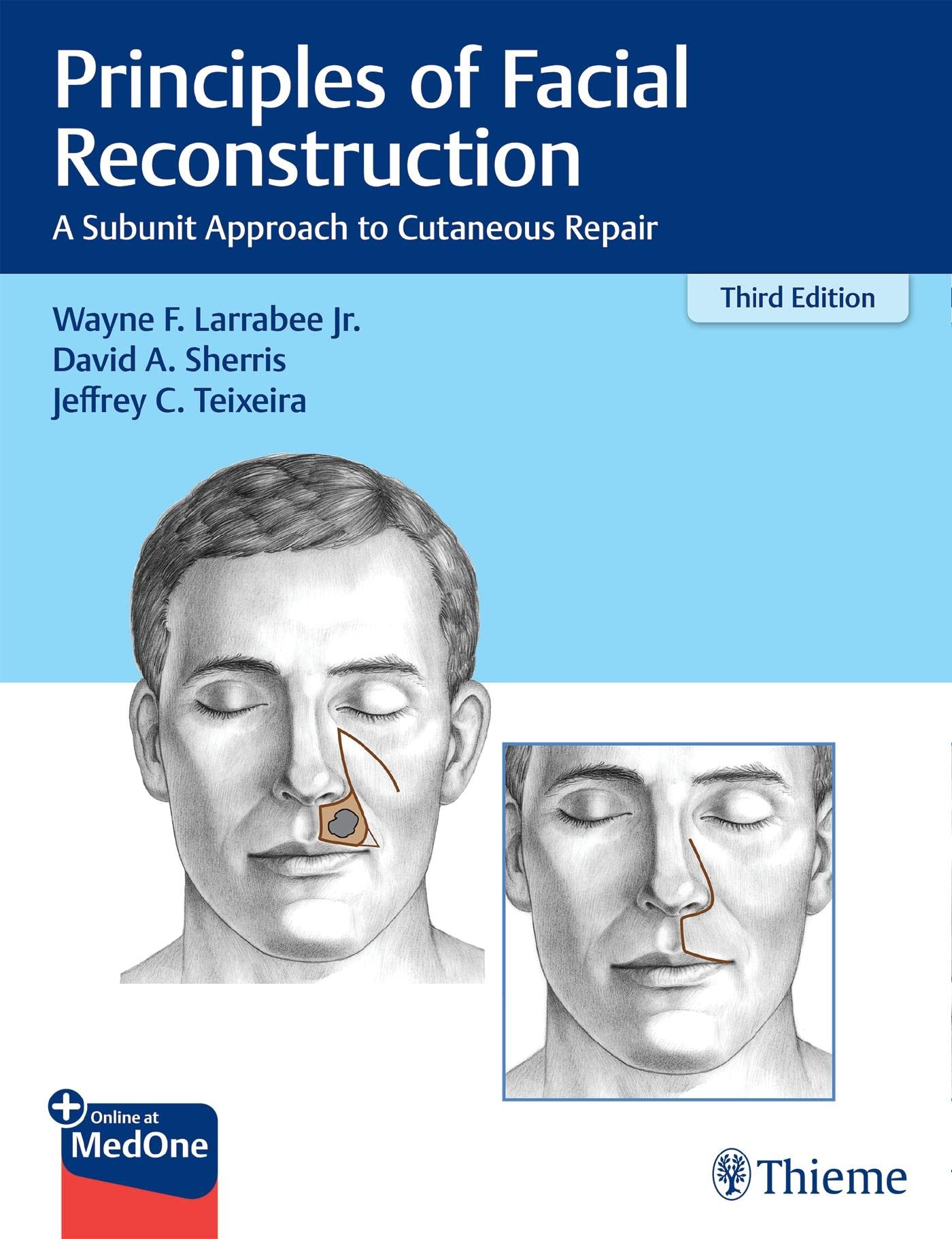 Coperta cărții "Principles of Facial Reconstruction" de autor necunoscut