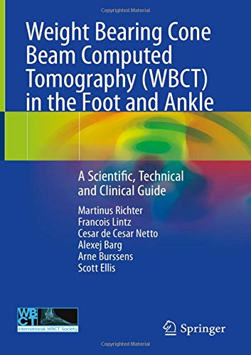 Coperta cărții "Weight Bearing Cone Beam Computed Tomography (WBCT) in the Foot and Ankle: A Scientific, Technical and Clinical Guide" de autor necunoscut