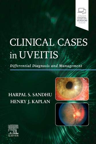 Coperta cărții "Clinical Cases in Uveitis: Differential Diagnosis and Management" de autor necunoscut