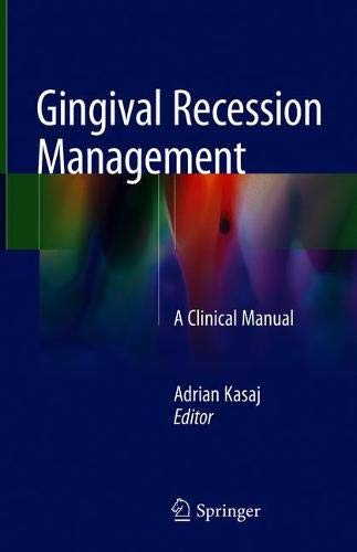 Coperta cărții "Gingival Recession Management" de autor necunoscut