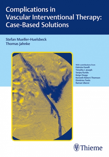 Coperta cărții "Complications in Vascular Interventional Therapy: Case-Based Solutions" de autor necunoscut