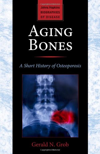 Coperta cărții "Aging Bones, A Short History of Osteoporosis" de autor necunoscut