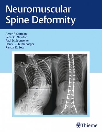 Coperta cărții "Neuromuscular Spine Deformity" de autor necunoscut