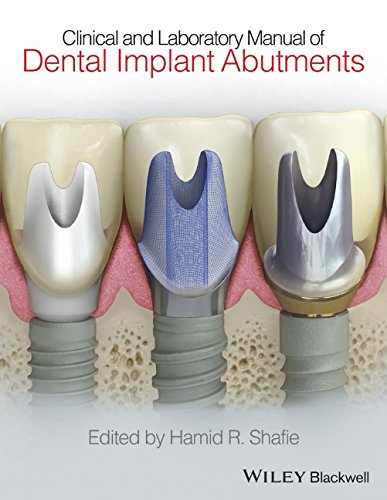 Coperta cărții "Clinical and Laboratory Manual of Dental Implant Abutments" de autor necunoscut