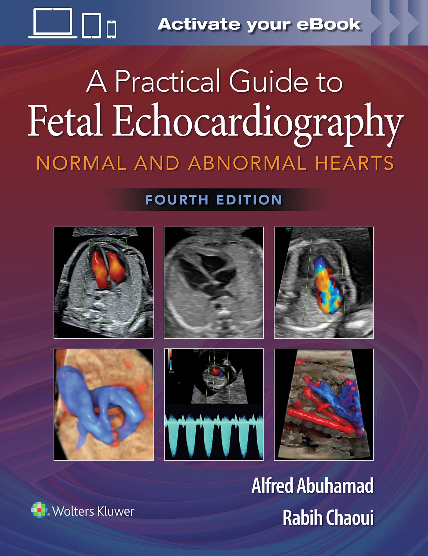 Coperta cărții "A Practical Guide to Fetal Echocardiography: Normal and Abnormal Hearts" de autor necunoscut