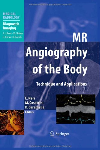 Coperta cărții "MR Angiography of the Body: Technique and Clinical Applications (Medical Radiology / Diagnostic Imaging)" de autor necunoscut