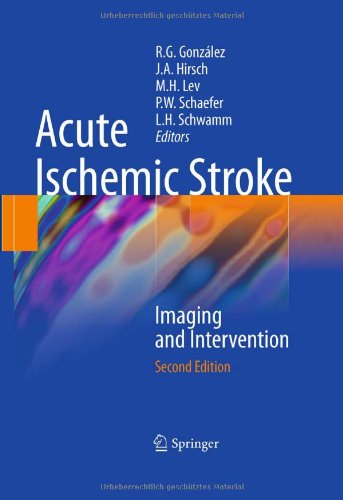 Coperta cărții "Acute Ischemic Stroke: Imaging and Intervention" de autor necunoscut