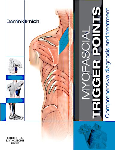 Coperta cărții "Myofascial Trigger Points: Comprehensive diagnosis and treatment, 1e" de autor necunoscut