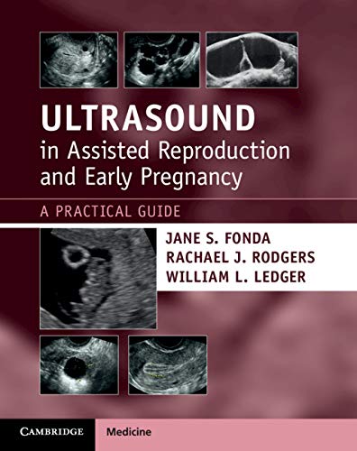Coperta cărții "Ultrasound in Assisted Reproduction and Early Pregnancy: A Practical Guide" de autor necunoscut